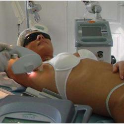 Centre épilation Laser Rouen