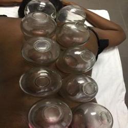 Aidao Lin - Acupuncteur à Pantin