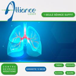 Alliance Laser Anti-tabac