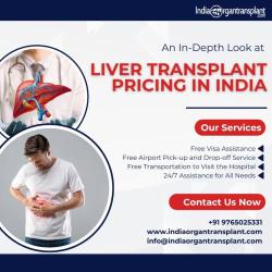 Best Liver Transplant Hospital In India