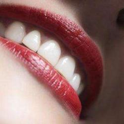 Be Smile - Blanchiment Des Dents