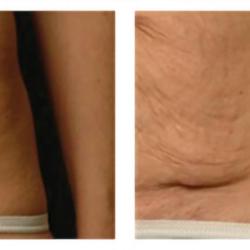 Centre Laser Beauté Troyes
