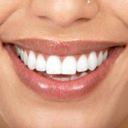Clinique Du Sourire _ Dr Messner