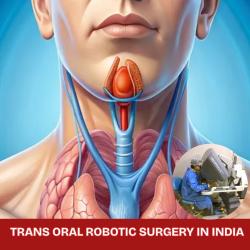 Coût De La Chirurgie Robotique Tors En Inde