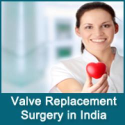 Coût D'une Chirurgie De Remplacement Valvulaire En Inde