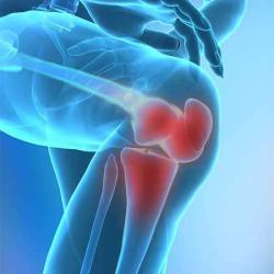 Docteur Rémi Chastel Chirurgien Orthopédique
