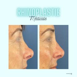 Dr Christophe Reinbold - Chirurgien Esthétique Lyon Villeurbanne