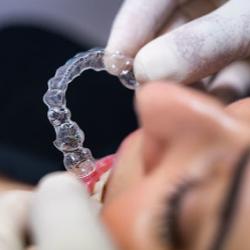 Dr Olivier Guedj - Paris | Orthodontie