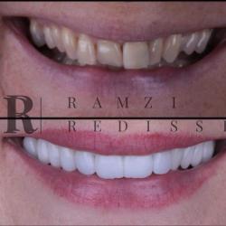 Dr Ramzi Redissi - Chirurgien Dentiste - Paris 8