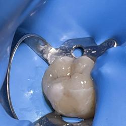 Dr Yann Lainé - Chirurgien Dentiste Poissy