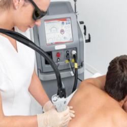 Epilation Laser Médical