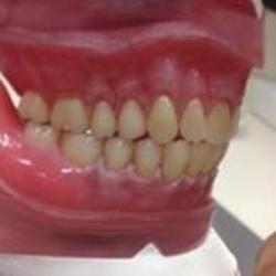 Epsilon Dentik
