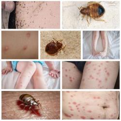 Expert Anti Parasitaire Deratisation Traitement Punaises De Lit