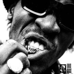 Grillzstreet - Grillz Sur Mesure
