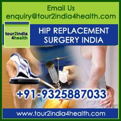 Hip Replacement Surgery Cost India