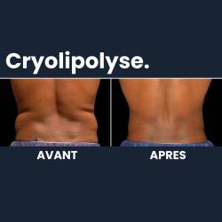 Institut Kalyaan - Amincissement & Anti-âge