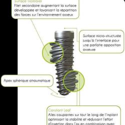 Kontact Implant Dentaire