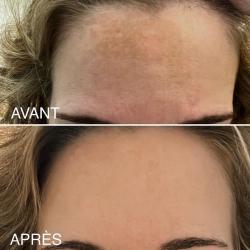 La Clinique Laser Nice - Centre D'épilation Laser Et Médecine Esthétique