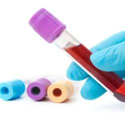 Laboratoire Analyses De Biologie Médicale