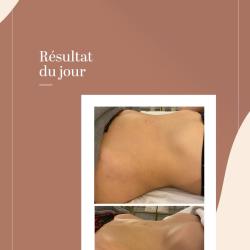 Les Jolies Pommettes - Drainage Lymphatique Renata França & Massage Musculaire Du Visage & Plasma Lift