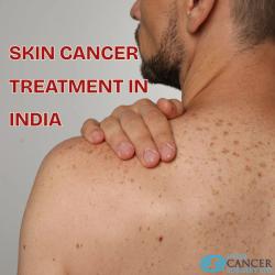 Les Meilleurs Chirurgiens Spécialisés Dans Le Cancer De La Peau En Inde