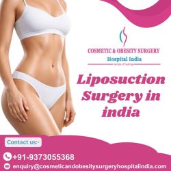 Liposuction In India