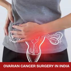Low Cost Ovarian Cancer Surgery In India