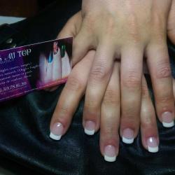 Ongles Au Top