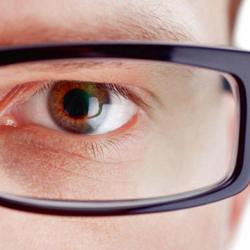 Optic Contact