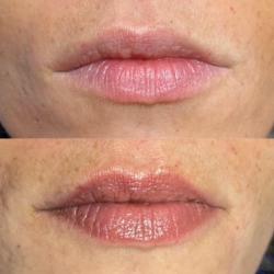 Remake Studio® Caen - Maquillage Permanent Rehaussement De Cils