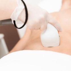 Secret De Jouvence - Epilation Définitive Lumière Pulsée & Peeling - Reims