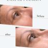 Lash-lift coréen