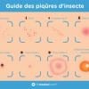 Guide des piqures de nuisibles volants ou rampants(punaises de lit, araignées, Antrenes de tapis, sclérodermes.