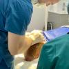 Greffe de cheveux FUE à Lyon