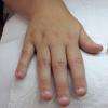 Ongles rongés avant
