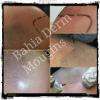 Tricopigmentation capillaire. Micro pigmentation capillaire.