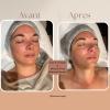soin visage miracle face 