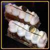  Le Millefeuille Caramélisé 
