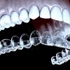 Aligneurs invisibles d'orthodontie à Ferney Voltaire
26 Avenue Voltaire 01210 Ferney Voltaire