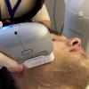Traitement du visage lifting médical HIFU