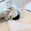 Traitement de la cellulite par Velashape 3 