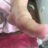 beauté des pieds, callosités 