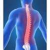 Dr Emmanuel Braun Nancy : Chirurgie rachidienne lombaire et Chirurgie rachidienne cervicale 
