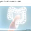 Endoscopie digestive basse – colonoscopie, sigmoïdoscopie, rectoscopie, anuscopie.

Les diverses procédures d’endoscopie digestive sont essentielles dans la prise en charge des patients. Ce sont, non seulement des examens complémentaires précieux pour la surveillance, la prévention et le diagnostic de certaines pathologies, mais il s’agit aussi le plus souvent d’interventions à visée thérapeutique. Les endoscopies nécessitent presque toujours une préparation digestive, un jeun et/ou une purge, souvent une sédation voir une anesthésie et une hospitalisation au moins en procédure ambulatoire.