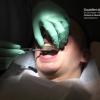 Gouttiere dentaire sur mesure / Dr. Eric Hazan, Paris 16, http://www.hazan.eu