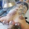 Ventouses et lampe infrarouge
