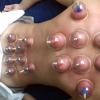 ventouse sèche st Priest
"Je suis réflexologue (réflexothérapie plantaire, palmaire, auriculaire, faciale) avec d'autre outils de soins comme le massage ostheo articulaire chinois Tuina (qui peut se faire habilles ou pas, avec ou sans huile, assis, debout, couché) respectant ainsi la condition physique, morale et culturel de la personne. Je vous propose aussi des outils psycho corporel pour s'intéresser à la sphère du psychisme (émotionnel) grâce au qigong (gymnastique interne chinoise) et du magnétisme japonais Reiki (le magnétisme peut se faire aussi sur des animaux (cf mon site internet a ce sujet) nous allons travailler sur les 3 plans de la personne: 1/psychique émotionnel 2/anatomique 3/énergétique animateur sportif taichi, qigong, méditation, automassage."