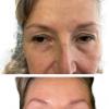 Résultat après un soin visage complet au plasma russe
Avant : teint terne, traits fatigués, peau relâchée
Après : peau repulpée, teint lumineux, visage visiblement revitalisé ✨
Le plasma russe stimule naturellement la régénération de la peau pour un coup d’éclat immédiat, sans injection ni chirurgie.