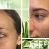 Résultat après un maquillage permanent des sourcils
Avant : sourcils très fins, clairsemés, peu visibles
Après : ligne redessinée, regard structuré, résultat