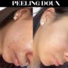 Résultat après un peeling marin naturel au spicules
Avant : boutons, inflammation, pores visibles
Après : peau plus lisse, boutons atténués, teint apaisé et plus uniforme ✨
Ce soin 100 % naturel purifie la peau en profondeur grâce aux micro-aiguilles marines et favorise la régénération pour une peau plus saine, naturellement.